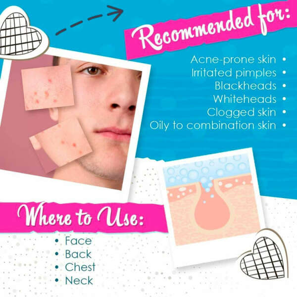 BYE BYE BLEMISH ACNE DRYING LOTION | BBBDLOR0001 - Image 